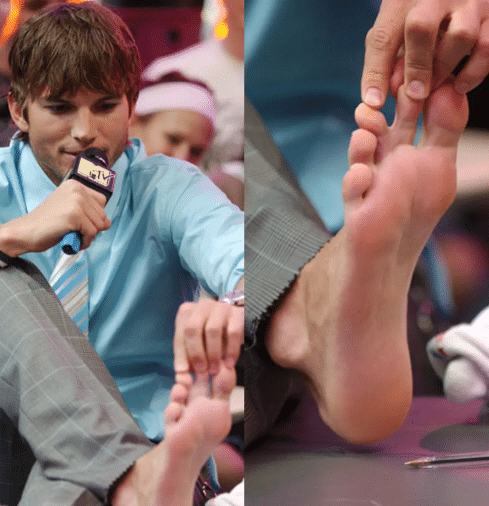 The Rapper Weekend Toes Webbed Toes Celebrities 60 Photos - Moonagedaydream.film